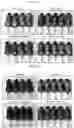 Fig. 11 - Composition compromising dunnione as effective ingredient for prevention or alleviation of hair loss
