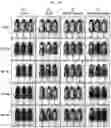 Fig. 14 - Composition compromising dunnione as effective ingredient for prevention or alleviation of hair loss
