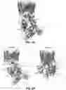 Fig. 03 - STRUCTURAL BASIS FOR OUTER MEMBRANE USHER ACTIVATION TO CATALYZE P PILUS ASSEMBLY