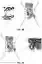 Fig. 07 - STRUCTURAL BASIS FOR OUTER MEMBRANE USHER ACTIVATION TO CATALYZE P PILUS ASSEMBLY