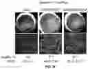 Fig. 12 - COMPOSITIONS AND METHODS FOR TREATING AGE-RELATED MACULAR DEGENERATION AND GEOGRAPHIC ATROPHY