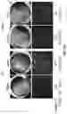 Fig. 15 - COMPOSITIONS AND METHODS FOR TREATING AGE-RELATED MACULAR DEGENERATION AND GEOGRAPHIC ATROPHY