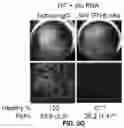 Fig. 19 - COMPOSITIONS AND METHODS FOR TREATING AGE-RELATED MACULAR DEGENERATION AND GEOGRAPHIC ATROPHY