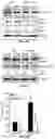 Fig. 22 - COMPOSITIONS AND METHODS FOR TREATING AGE-RELATED MACULAR DEGENERATION AND GEOGRAPHIC ATROPHY