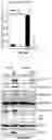 Fig. 23 - COMPOSITIONS AND METHODS FOR TREATING AGE-RELATED MACULAR DEGENERATION AND GEOGRAPHIC ATROPHY
