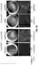 Fig. 30 - COMPOSITIONS AND METHODS FOR TREATING AGE-RELATED MACULAR DEGENERATION AND GEOGRAPHIC ATROPHY