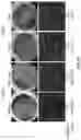 Fig. 40 - COMPOSITIONS AND METHODS FOR TREATING AGE-RELATED MACULAR DEGENERATION AND GEOGRAPHIC ATROPHY
