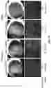 Fig. 41 - COMPOSITIONS AND METHODS FOR TREATING AGE-RELATED MACULAR DEGENERATION AND GEOGRAPHIC ATROPHY
