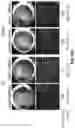 Fig. 64 - COMPOSITIONS AND METHODS FOR TREATING AGE-RELATED MACULAR DEGENERATION AND GEOGRAPHIC ATROPHY