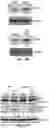 Fig. 67 - COMPOSITIONS AND METHODS FOR TREATING AGE-RELATED MACULAR DEGENERATION AND GEOGRAPHIC ATROPHY