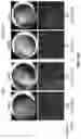 Fig. 70 - COMPOSITIONS AND METHODS FOR TREATING AGE-RELATED MACULAR DEGENERATION AND GEOGRAPHIC ATROPHY