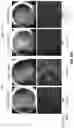 Fig. 71 - COMPOSITIONS AND METHODS FOR TREATING AGE-RELATED MACULAR DEGENERATION AND GEOGRAPHIC ATROPHY