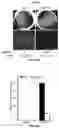 Fig. 78 - COMPOSITIONS AND METHODS FOR TREATING AGE-RELATED MACULAR DEGENERATION AND GEOGRAPHIC ATROPHY