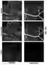 Fig. 82 - COMPOSITIONS AND METHODS FOR TREATING AGE-RELATED MACULAR DEGENERATION AND GEOGRAPHIC ATROPHY