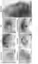 Fig. 05 - Methods and compositions to modulate hair growth