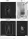 Fig. 12 - Methods and compositions to modulate hair growth
