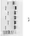 Fig. 02 - Prostate-specific membrane antigen cars and methods of use thereof