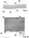 Fig. 06 - Multilayered blood product