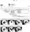 Fig. 11 - METHOD FOR PRODUCING CELL MASS INCLUDING PITUITARY TISSUE, AND CELL MASS THEREOF
