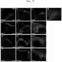 Fig. 16 - METHOD FOR PRODUCING CELL MASS INCLUDING PITUITARY TISSUE, AND CELL MASS THEREOF