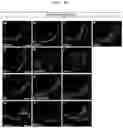 Fig. 18 - METHOD FOR PRODUCING CELL MASS INCLUDING PITUITARY TISSUE, AND CELL MASS THEREOF