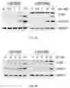 Fig. 04 - Composition for preventing or treating glioblastoma comprising A. De Candolle, Ruprecht or 