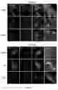 Fig. 06 - Composition for preventing or treating glioblastoma comprising A. De Candolle, Ruprecht or 