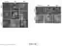 Fig. 11 - Composition for preventing or treating glioblastoma comprising A. De Candolle, Ruprecht or 