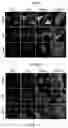 Fig. 15 - Composition for preventing or treating glioblastoma comprising A. De Candolle, Ruprecht or 