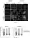 Fig. 17 - Composition for preventing or treating glioblastoma comprising A. De Candolle, Ruprecht or 