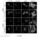 Fig. 21 - Composition for preventing or treating glioblastoma comprising A. De Candolle, Ruprecht or 