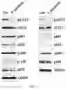 Fig. 27 - Composition for preventing or treating glioblastoma comprising A. De Candolle, Ruprecht or 