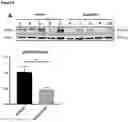 Fig. 03 - Type I diabetes therapy
