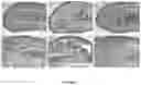 Fig. 03 - Compositions and Methods for Safe Treatment of Rhinitis