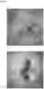Fig. 02 - Norovirus vaccine