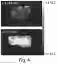 Fig. 05 - COMPOSITIONS AND METHODS RELATED TO CELL SYSTEMS FOR PENETRATING SOLID TUMORS