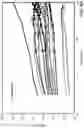 Fig. 06 - COMPOSITIONS AND METHODS FOR ENHANCING TRANSPORT THROUGH MUCUS