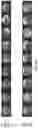 Fig. 17 - Methods and compositions for treating cone-rod retinal dystrophy