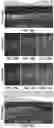 Fig. 22 - Methods and compositions for treating cone-rod retinal dystrophy
