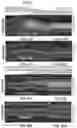 Fig. 25 - Methods and compositions for treating cone-rod retinal dystrophy