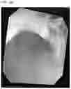 Fig. 15 - ORGAN DIRECTED GENE DELIVERY