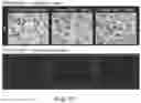 Fig. 09 - Microbubble tether for diagnostic and therapeutic applications
