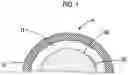 Fig. 02 - Antimicrobial compression wrap