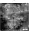 Fig. 06 - Dried implant composition and injectable aqueous implant formulation
