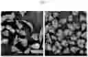 Fig. 07 - Dried implant composition and injectable aqueous implant formulation