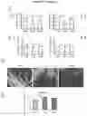 Fig. 16 - Biocompatible hydrogel compositions and uses thereof