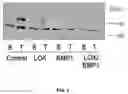 Fig. 06 - EXTRACELLULAR MATRIX AND ITS USE FOR REGULATING THE DIFFERENTIATION OF MESENCHYMAL STEM CELLS