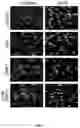 Fig. 07 - EXTRACELLULAR MATRIX AND ITS USE FOR REGULATING THE DIFFERENTIATION OF MESENCHYMAL STEM CELLS