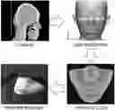 Fig. 01 - Multi-layer skin substitute products and methods of making and using the same