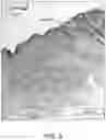 Fig. 04 - Multi-layer skin substitute products and methods of making and using the same